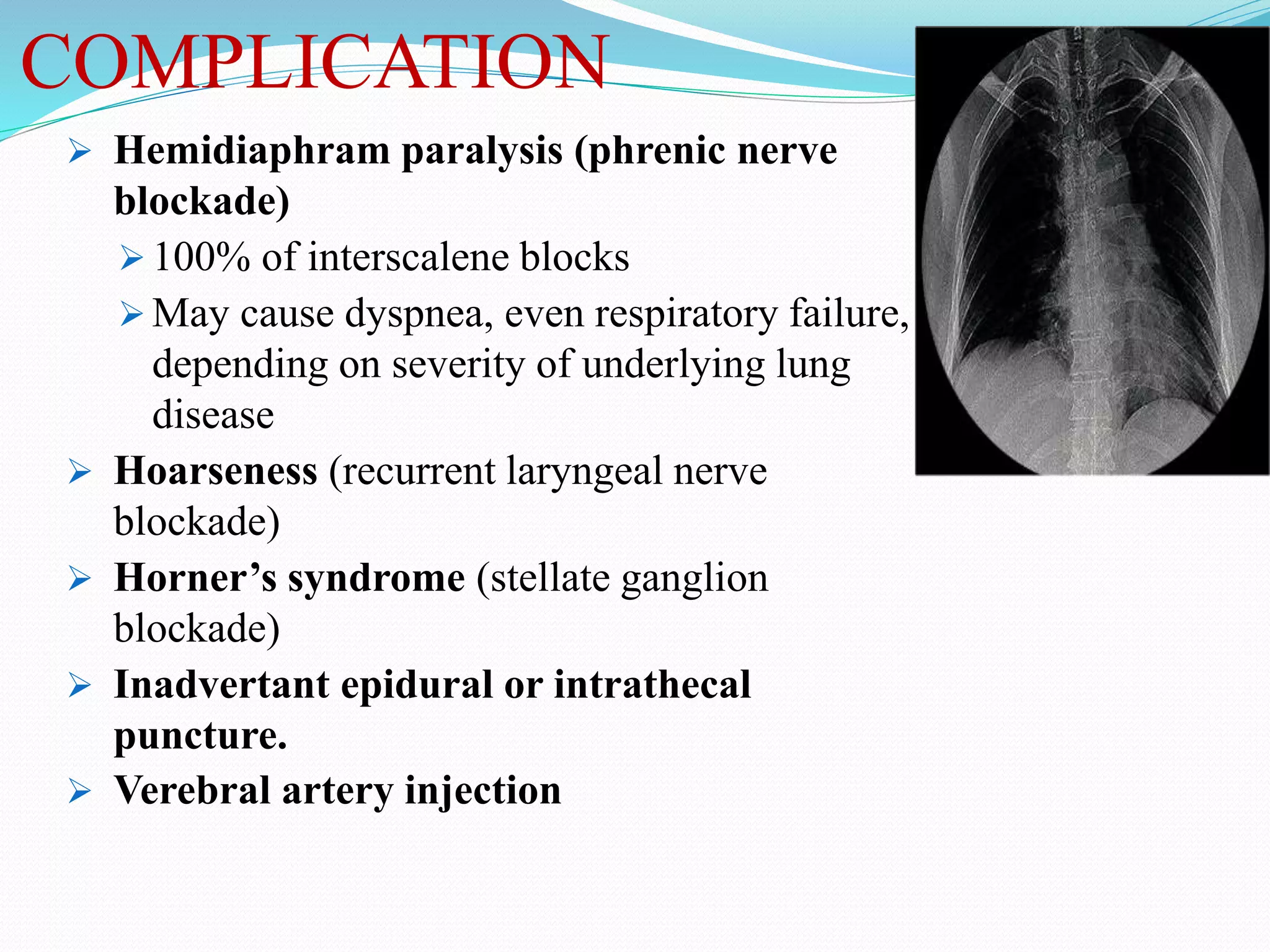COMPLICATION
 Hemidiaphram paralysis (phrenic nerve
blockade)
 100% of interscalene blocks
 May cause dyspnea, even respiratory failure,
depending on severity of underlying lung
disease
 Hoarseness (recurrent laryngeal nerve
blockade)
 Horner’s syndrome (stellate ganglion
blockade)
 Inadvertant epidural or intrathecal
puncture.
 Verebral artery injection
 