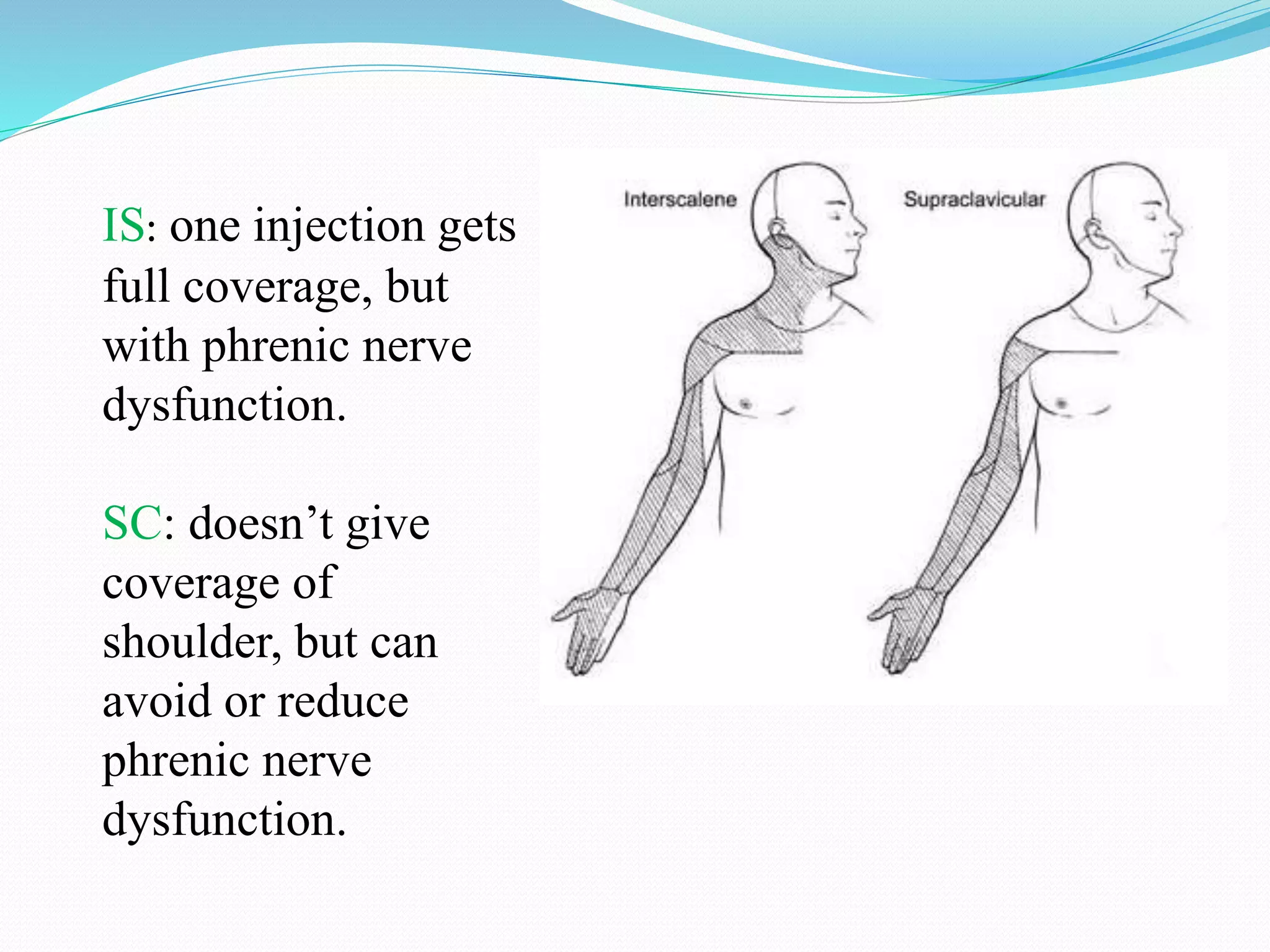 IS: one injection gets
full coverage, but
with phrenic nerve
dysfunction.
SC: doesn’t give
coverage of
shoulder, but can
avoid or reduce
phrenic nerve
dysfunction.
 