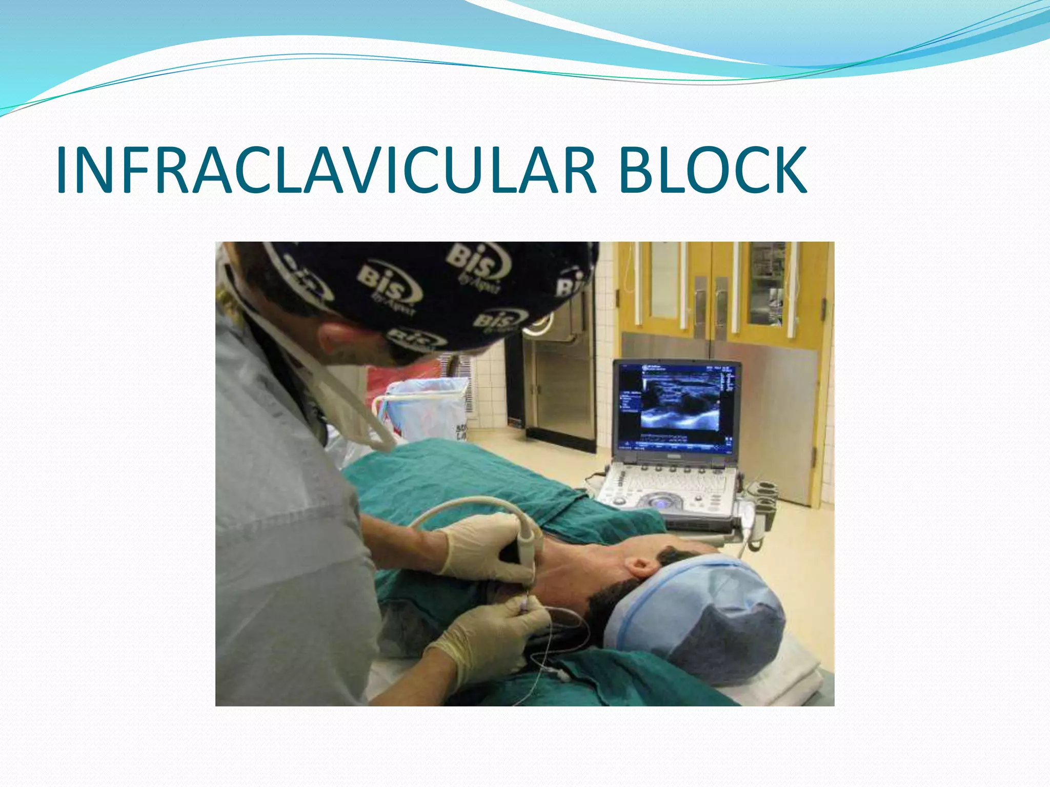 INFRACLAVICULAR BLOCK
 