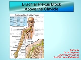 Brachial Plexus Block
Above the Clavicle
Edited by
Dr. M Dorgham
Under supervision of
Proff Dr. Amr Abdelfattah
 