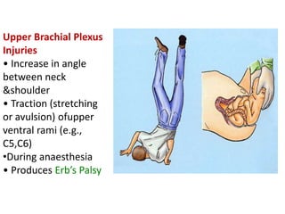 Upper Brachial Plexus
Injuries
• Increase in angle
between neck
&shoulder
• Traction (stretching
or avulsion) ofupper
ventral rami (e.g.,
C5,C6)
•During anaesthesia
• Produces Erb’s Palsy
 