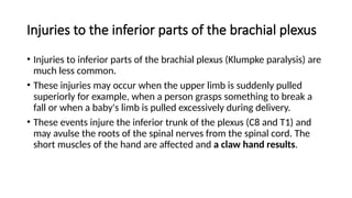 Fall Plexus Event Comprehensive Overview of the Brachial Plexus Anatomy, Injuries, and ...