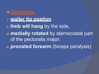  Deformity:
 waiter tip postion
c. limb will hang by the side,
d. medially rotated by sternocostal part
of the pectoralis major;
e. pronated forearm (biceps paralysis)
 
