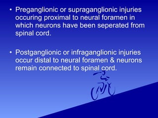 • Preganglionic or supraganglionic injuries
occuring proximal to neural foramen in
which neurons have been seperated from
spinal cord.
• Postganglionic or infraganglionic injuries
occur distal to neural foramen & neurons
remain connected to spinal cord.
 