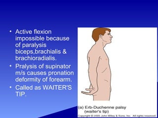 • Active flexion
impossible because
of paralysis
biceps,brachialis &
brachioradialis.
• Pralysis of supinator
m/s causes pronation
deformity of forearm.
• Called as WAITER'S
TIP.
 