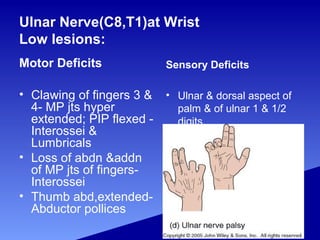 Ulnar Nerve(C8,T1)at Wrist
Low lesions:
Motor Deficits
• Clawing of fingers 3 &
4- MP jts hyper
extended; PIP flexed -
Interossei &
Lumbricals
• Loss of abdn &addn
of MP jts of fingers-
Interossei
• Thumb abd,extended-
Abductor pollices
Sensory Deficits
• Ulnar & dorsal aspect of
palm & of ulnar 1 & 1/2
digits.
 