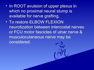 • In ROOT avulsion of upper plexus in
which no proximal neural stump is
available for nerve grafting,
• To restore ELBOW FLEXION
neurotization between intercostal nerves
or FCU motor fascicles of ulnar nerve &
musculocutaneous nerve may be
considered.
 