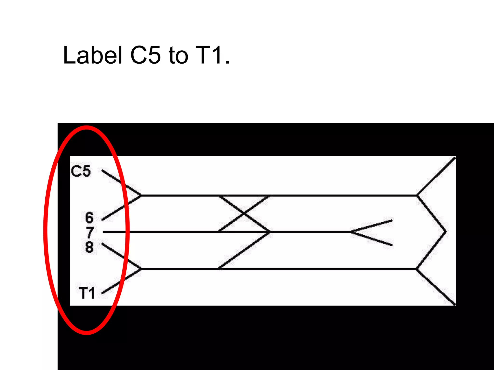 Label C5 to T1.
 
