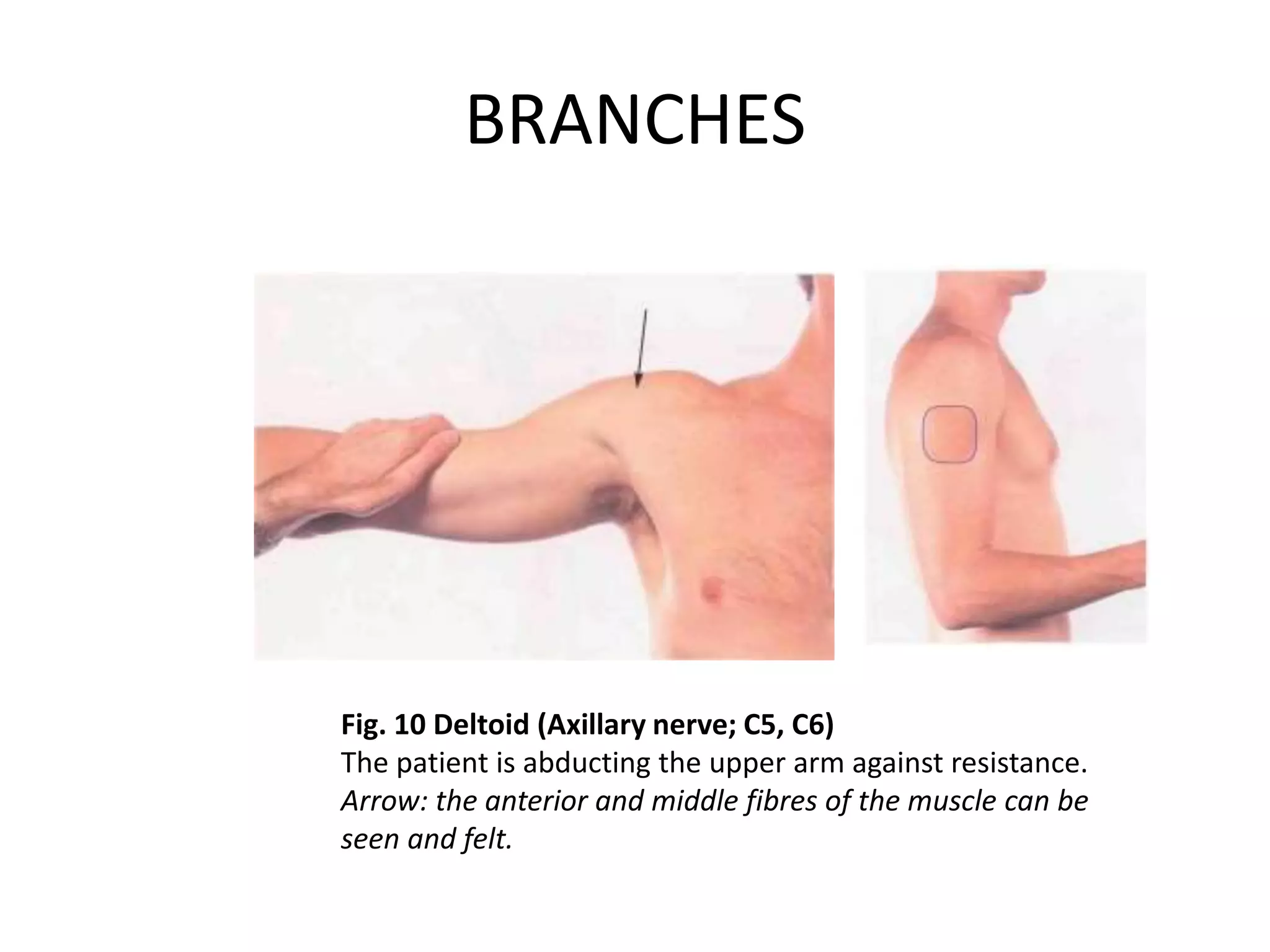 BRANCHES
Fig. 10 Deltoid (Axillary nerve; C5, C6)
The patient is abducting the upper arm against resistance.
Arrow: the anterior and middle fibres of the muscle can be
seen and felt.
 
