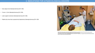 • Early stage tumors Banerjee,Kamrava,2014 :556)
• Tumors < 4-5cm (Banerjee,Kamrava,2014 :556)
• Lower vaginal involvement (Banerjee,Kamrava,2014 :556)
• Patients who have had a supracervical hysterectomy (Banerjee,Kamrava,2014 :556)
Figure 5:https://www.google.com/url?sa=i&url=https%3A%2F%2Fwww.iaea.org%2Fnewscenter%2Fnews%2Fcombining-external-
radiation-with-high-dose-rate-brachytherapy-effective-for-cervical-cancer-iaea-study-
confirms&psig=AOvVaw1vGZrB_kFyBg3RMkBEMUQF&ust=1692185437375000&source=images&cd=vfe&opi=89978449&ved=0CBAQj
RxqFwoTCJDz0ZnI3oADFQAAAAAdAAAAABAE
4. INDICATIONS FOR GYNAECOLOGICALCANCERS
 