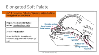 Elongated Soft Palate
ESP  mevsimsel / obezite/ Yaşlılık ve patolojik olarak
İlerleyebilen bir durumdur.
İnspirasyon sırasında flutter
sesleri dışrıdan duyulabilir.
Boğulma / Suffocation
Bazen ileri ESP’ler Rima glottidis
dayanarak boğulma/hata ölümlere yol
açar.
Dr. Hadi ALİHOSSEİNİ
 
