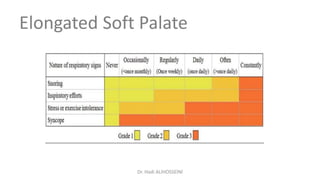 Elongated Soft Palate
Dr. Hadi ALİHOSSEİNİ
 