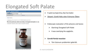 Elongated Soft Palate
 9 aylık kısırlaştırılmış Dişi İran kedisi
 Şikayeti: Sürekli Nüks eden Pulmoner Ödem
 Endoscopic evaluation of the pharynx and larynx:
 Overlong Elongated Soft Palate
 It was overlying the epiglottis.
 Cerrahi Partial resection
 Tüm Solunum problemleri giderildi.
Dr. Hadi ALİHOSSEİNİ
 