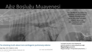 Ağız Boşluğu Muayenesi
İleri LARYNGEAL hastalıklarında
olgularında Larenks kıkırdakları
etkilenir ve Kollaps oluşur.
Ani ve uzun süreli Laryngeal
Collapse olgularında
ACİL FULMİNANT AKCİĞER
ÖDEMİ Gelişebilir.
Laryngeal paralysis olan köpeklerde
polyneuropathy or polymyopathy’ye bağlı
Megaözefagus gelişebilir.
Megaesophagus  Aspiration pneumonia ..!
Dr. Hadi ALİHOSSEİNİ
 
