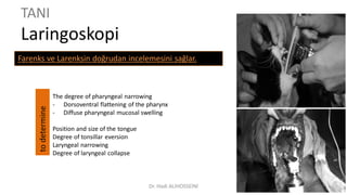 TANI
Laringoskopi
Farenks ve Larenksin doğrudan incelemesini sağlar.
The degree of pharyngeal narrowing
- Dorsoventral flattening of the pharynx
- Diffuse pharyngeal mucosal swelling
Position and size of the tongue
Degree of tonsillar eversion
Laryngeal narrowing
Degree of laryngeal collapse
todetermine
Dr. Hadi ALİHOSSEİNİ
 