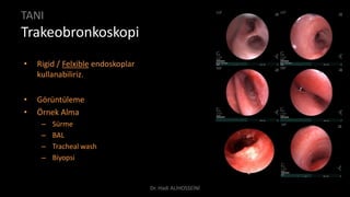 TANI
Trakeobronkoskopi
• Rigid / Felxible endoskoplar
kullanabiliriz.
• Görüntüleme
• Örnek Alma
– Sürme
– BAL
– Tracheal wash
– Biyopsi
Dr. Hadi ALİHOSSEİNİ
 