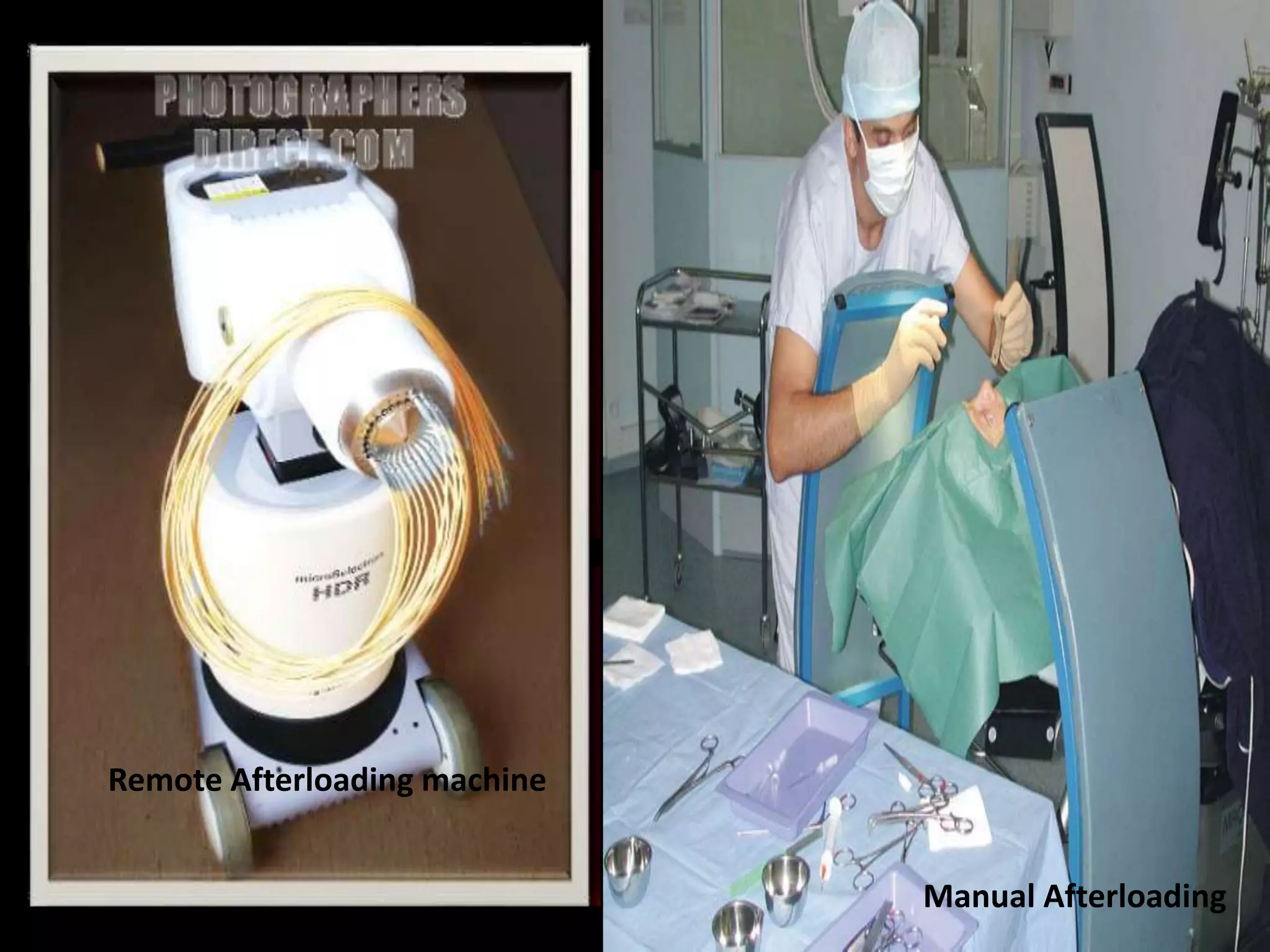 Brachytherapy | PPTX