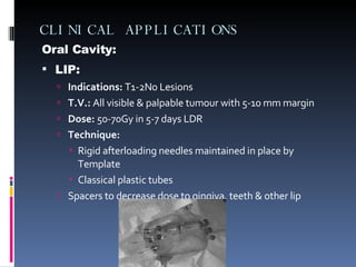 CLINICAL APPLICATIONS Oral Cavity: LIP: Indications:  T1-2N0 Lesions  T.V.:  All visible & palpable tumour with 5-10 mm margin Dose:  50-70Gy in 5-7 days LDR Technique:   Rigid afterloading needles maintained in place by Template Classical plastic tubes Spacers to decrease dose to gingiva, teeth & other lip 
