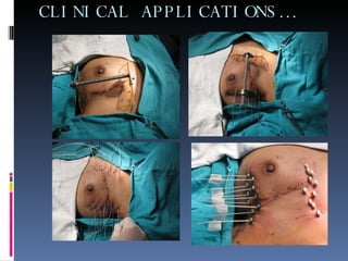CLINICAL APPLICATIONS… 