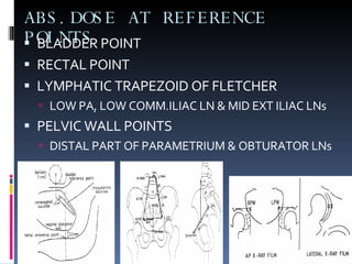 ABS.DOSE AT REFERENCE POINTS BLADDER POINT RECTAL POINT LYMPHATIC TRAPEZOID OF FLETCHER LOW PA, LOW COMM.ILIAC LN & MID EXT ILIAC LNs PELVIC WALL POINTS DISTAL PART OF PARAMETRIUM & OBTURATOR LNs 