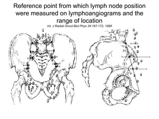 Reference point from which lymph node position were measured on lymphoangiograms and the range of location Int. J Radiat Oncol Biol Phys 34:167-172, 1996 