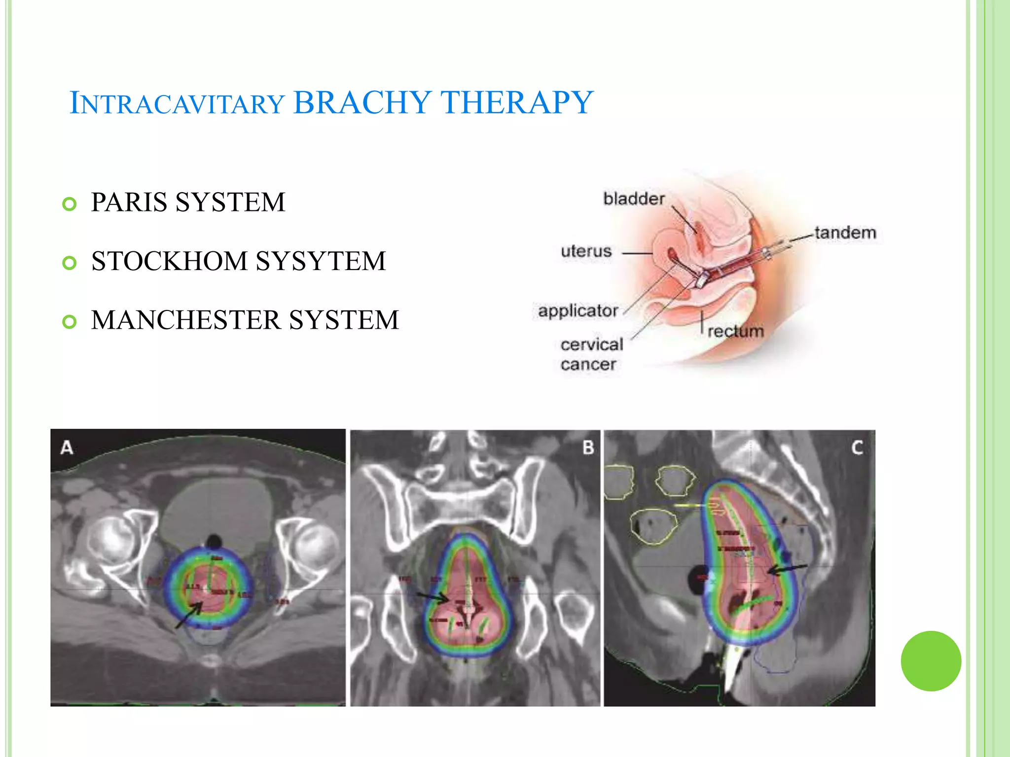 Brachytherapy dosimetry systems .R | PPTX