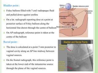 Brachytherapy dosimetry systems .R | PPTX