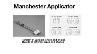Manchester Applicator
Tandem of variable length and angles
Ovoids of di
ff
erent sizes and shapes
 