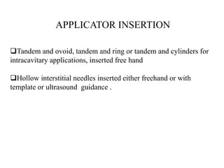 Tandem and ovoid, tandem and ring or tandem and cylinders for
intracavitary applications, inserted free hand
Hollow interstitial needles inserted either freehand or with
template or ultrasound guidance .
APPLICATOR INSERTION
 