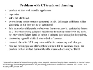 Problems with CT treatment planning
• produce artifact with metallic applicators
• expensive
• GTV not identified
• overestimate tumor contours compared to MRI (although additional width
contoured on CT may not be of detriment)
• fails to provide differentiation between the uterus, cervix, pariuterine tissues
so CT-based contouring guidelines recommend delineating entire cervix and uterus.
not provide sufficient detail of tumor if selected dose escalation is required,
• contouring sigmoid difficult due to lack of contrast
• contrast placed in OAR may cause artifact.in contouring wall of organ.
• requires moving patient after application from CT to treatment room: can
produce motion artifact that nullifies the increased accuracy of IGBT
*Viswanathan AN et al. Computed tomography versus magnetic resonance imaging-based contouring in cervical cancer
brachytherapy: results of a prospective trial and preliminary guidelines for standardized contours. Int J Radiat Oncol
Biol Phys2007;68:491–498
 
