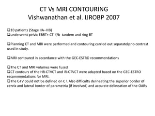 10 patients (Stage IIA–IIIB)
underwent pelvic EBRT+ CT f/b tandem and ring BT
Planning CT and MRI were performed and contouring carried out separately,no contrast
used in study.
MRI contoured in accordance with the GEC-ESTRO recommendations
The CT and MRI volumes were fused
CT contours of the HR-CTVCT and IR-CTVCT were adapted based on the GEC-ESTRO
recommendations for MRI.
The GTV could not be defined on CT. Also difficulty delineating the superior border of
cervix and lateral border of parametria (if involved) and accurate delineation of the OARs
CT Vs MRI CONTOURING
Vishwanathan et al. IJROBP 2007
 