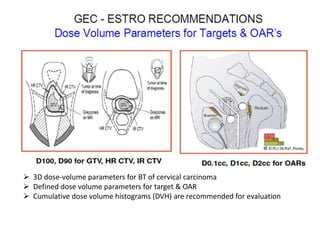  3D dose-volume parameters for BT of cervical carcinoma
 Defined dose volume parameters for target & OAR
 Cumulative dose volume histograms (DVH) are recommended for evaluation
 