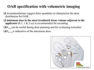 OAR specification with volumetric imaging
 recommendations suggest three quantities to characterize the dose
distribution for OAR. .
 minimum dose in the most irradiated tissue volume adjacent to the
applicator (0.1, 1 & 2 cc) is recommended for recording
D2 cc can be useful during dose planning and for evaluating toxicities
D0.1 cc is indicative of the maximum dose.
 