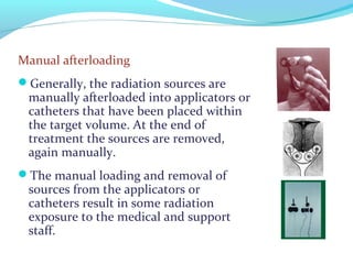 Manual afterloading
Generally, the radiation sources are
manually afterloaded into applicators or
catheters that have been placed within
the target volume. At the end of
treatment the sources are removed,
again manually.
The manual loading and removal of
sources from the applicators or
catheters result in some radiation
exposure to the medical and support
staff.
 