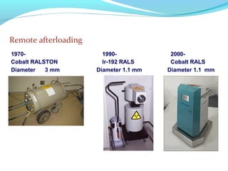 Remote afterloading
1970- 1990- 2000-
Cobalt RALSTON 　　 Ir-192 RALS Cobalt RALS
Diameter 3 mm Diameter 1.1 mm Diameter 1.1 mm
　　
 