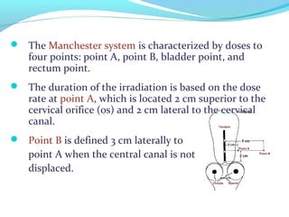  The Manchester system is characterized by doses to
four points: point A, point B, bladder point, and
rectum point.
 The duration of the irradiation is based on the dose
rate at point A, which is located 2 cm superior to the
cervical orifice (os) and 2 cm lateral to the cervical
canal.
 Point B is defined 3 cm laterally to
point A when the central canal is not
displaced.
 