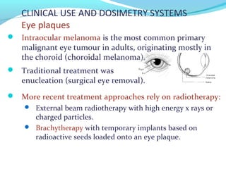 CLINICAL USE AND DOSIMETRY SYSTEMS
Eye plaques
 Intraocular melanoma is the most common primary
malignant eye tumour in adults, originating mostly in
the choroid (choroidal melanoma).
 Traditional treatment was
enucleation (surgical eye removal).
 More recent treatment approaches rely on radiotherapy:
 External beam radiotherapy with high energy x rays or
charged particles.
 Brachytherapy with temporary implants based on
radioactive seeds loaded onto an eye plaque.
 