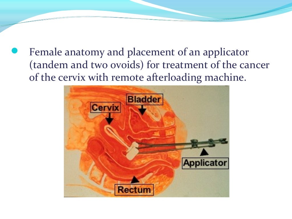 Brachytherapy msc lecture sam copy