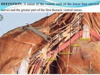 Define Ramus Bracial plexus injury localization and management | PPTX