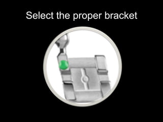 Position the bracket as precisely as
possible
 