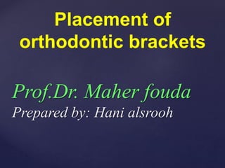 Placement of
orthodontic brackets
Prof.Dr. Maher fouda
Prepared by: Hani alsrooh
 