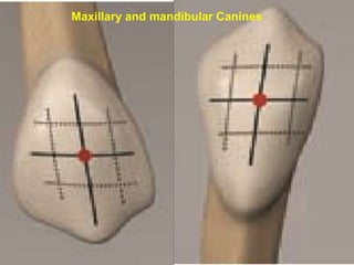 Maxillary and mandibular Canines
 