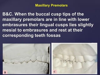 B&C. When the buccal cusp tips of the
maxillary premolars are in line with lower
embrasures their lingual cusps lies slightly
mesial to embrasures and rest at their
corresponding teeth fossas
 