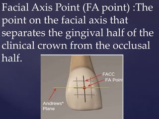 Facial Axis Point (FA point) :The
point on the facial axis that
separates the gingival half of the
clinical crown from the occlusal
half.
 