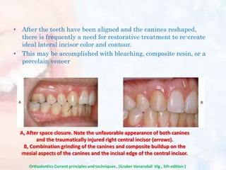 • After the teeth have been aligned and the canines reshaped,
there is frequently a need for restorative treatment to re-create
ideal lateral incisor color and contour.
• This may be accomplished with bleaching, composite resin, or a
porcelain veneer
A, After space closure. Note the unfavorable appearance of both canines
and the traumatically injured right central incisor (arrows).
B, Combination grinding of the canines and composite buildup on the
mesial aspects of the canines and the incisal edge of the central incisor.
Orthodontics Current principles and techniques , (Graber Vanarsdall Vig , 5th edition )
 
