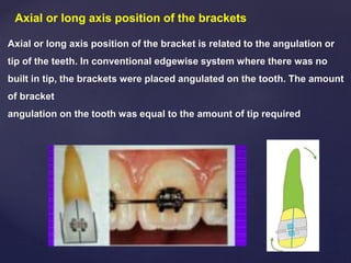 Axial or long axis position of the brackets
Axial or long axis position of the bracket is related to the angulation or
tip of the teeth. In conventional edgewise system where there was no
built in tip, the brackets were placed angulated on the tooth. The amount
of bracket
angulation on the tooth was equal to the amount of tip required
 