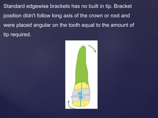 Standard edgewise brackets has no built in tip. Bracket
position didn't follow long axis of the crown or root and
were placed angular on the tooth equal to the amount of
tip required.
 