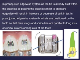 In preadjusted edgewise system as the tip is already built within
the brackets so placing the bracket similar to standard
edgewise will result in increase or decrease of built in tip. In
preadjusted edgewise system brackets are positioned on the
tooth so that their wings and scribe line are parallel to long axis
of clinical crowns or long axis of the tooth .
 