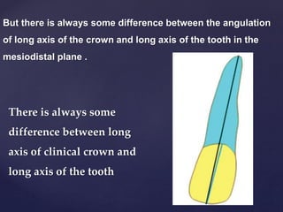 But there is always some difference between the angulation
of long axis of the crown and long axis of the tooth in the
mesiodistal plane .
There is always some
difference between long
axis of clinical crown and
long axis of the tooth
 