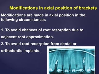Modifications in axial position of brackets
Modifications are made in axial position in the
following circumstances
1. To avoid chances of root resorption due to
adjacent root approximation.
2. To avoid root resorption from dental or
orthodontic implants.
 